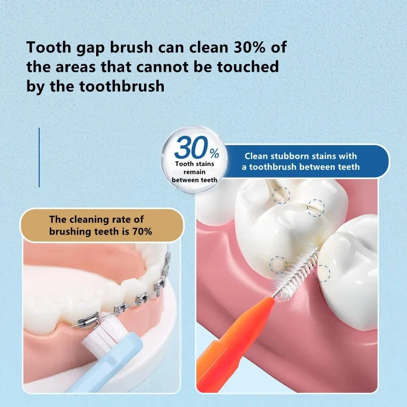 Interdental Brushes Health Care Teeth Whitening Interdental Cleaners Orthodontic Dental Tooth Brush Oral Hygiene Tool 30Pcs